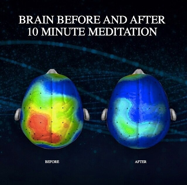 Brain heatmaps labeled before and after 10-minute meditation, shifting from red activity to calm blue