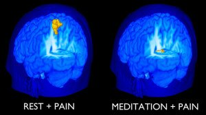Side-by-side fMRI scans comparing large yellow pain activity at rest versus nearly none in meditation